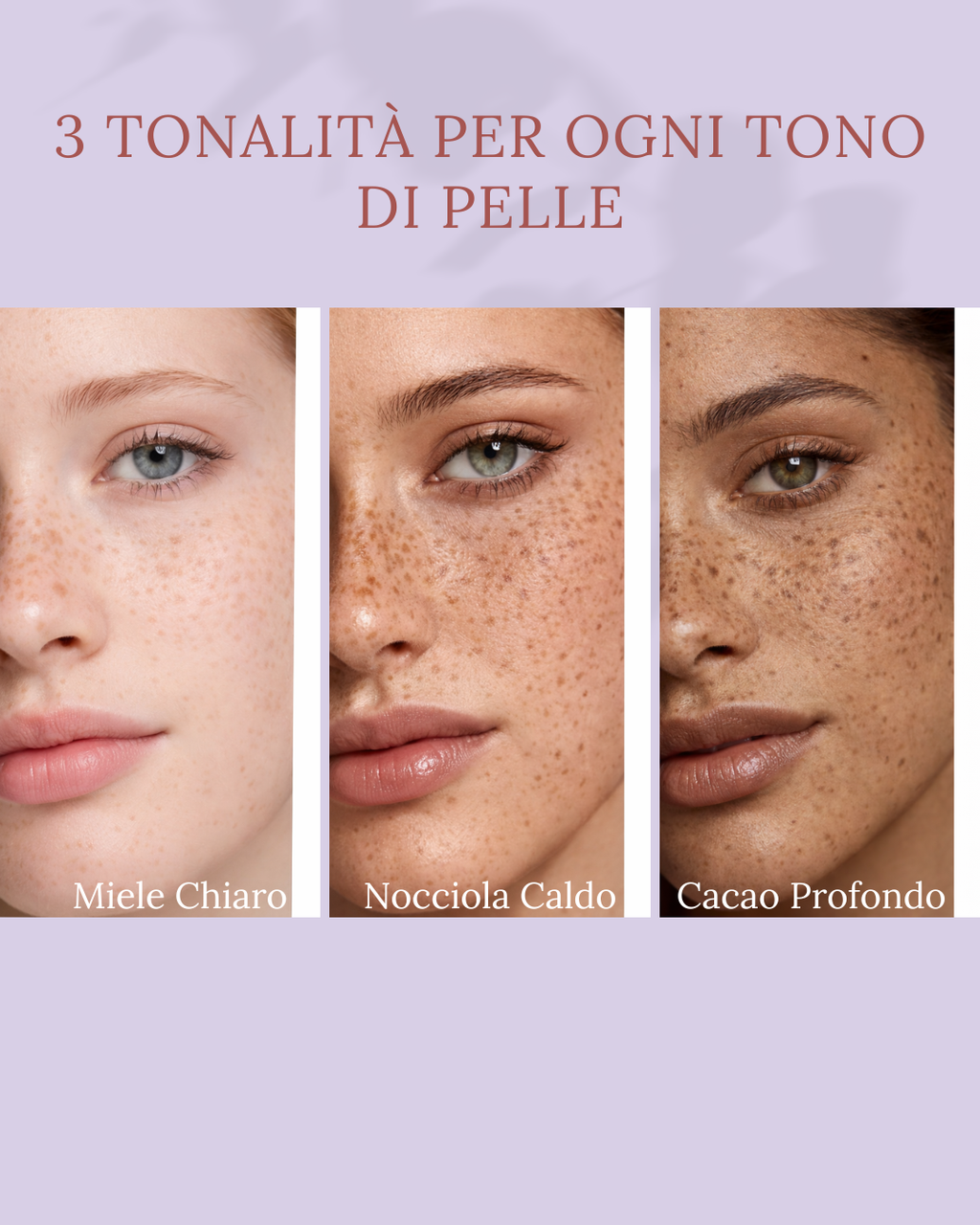 VÈRA™ Crush · Timbro Lentiggini – Effetto Naturale