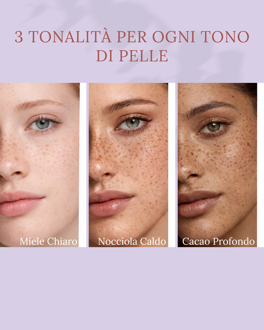 VÈRA™ Crush · Timbro Lentiggini – Effetto Naturale